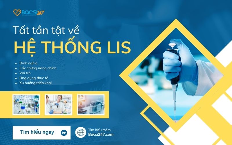 LIS là gì