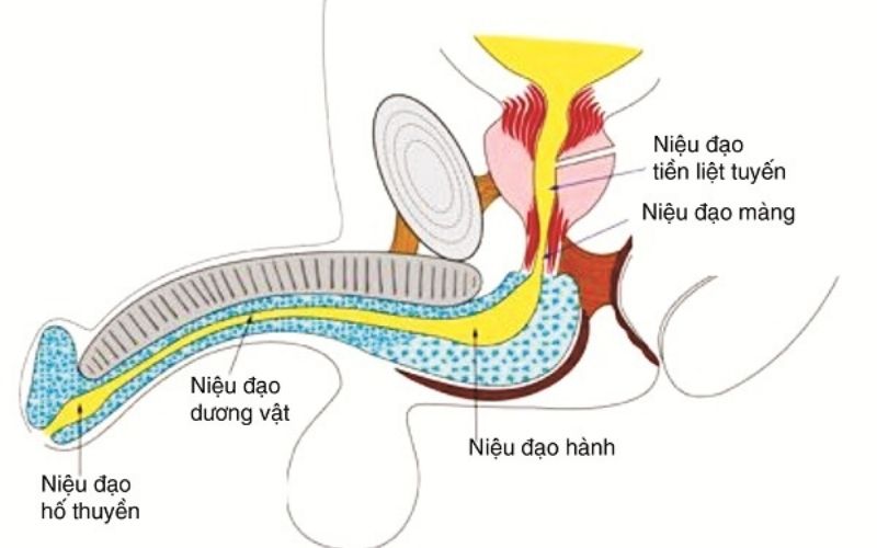 Xơ chít hẹp niệu đạo nguyên nhân tác động đến đau vùng chậu