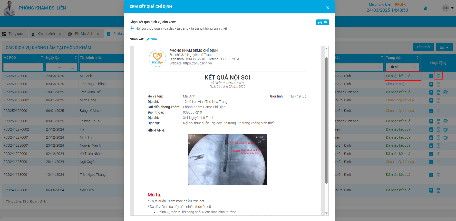 xem-ket-qua-cap-nhat-dich-vu
